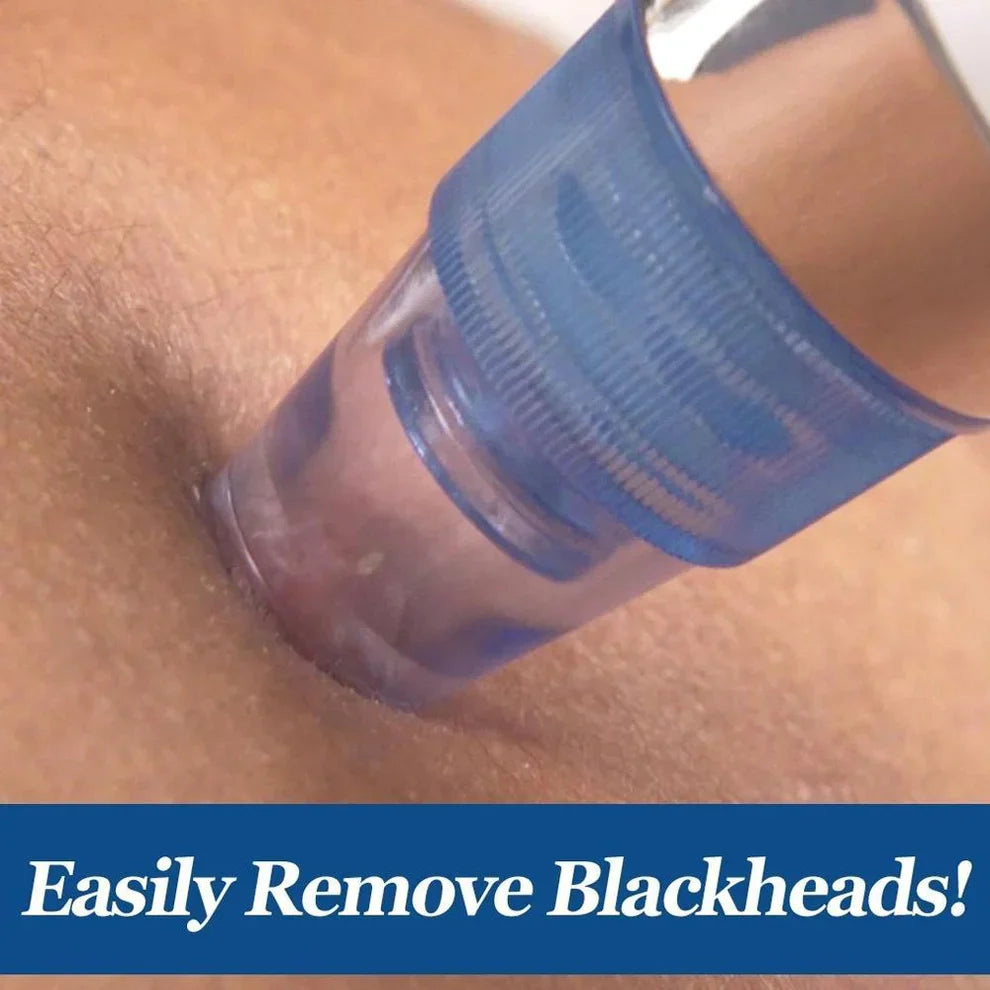 ClearPore™ 4-in-1 Blackhead & Acne Remover Vacuum