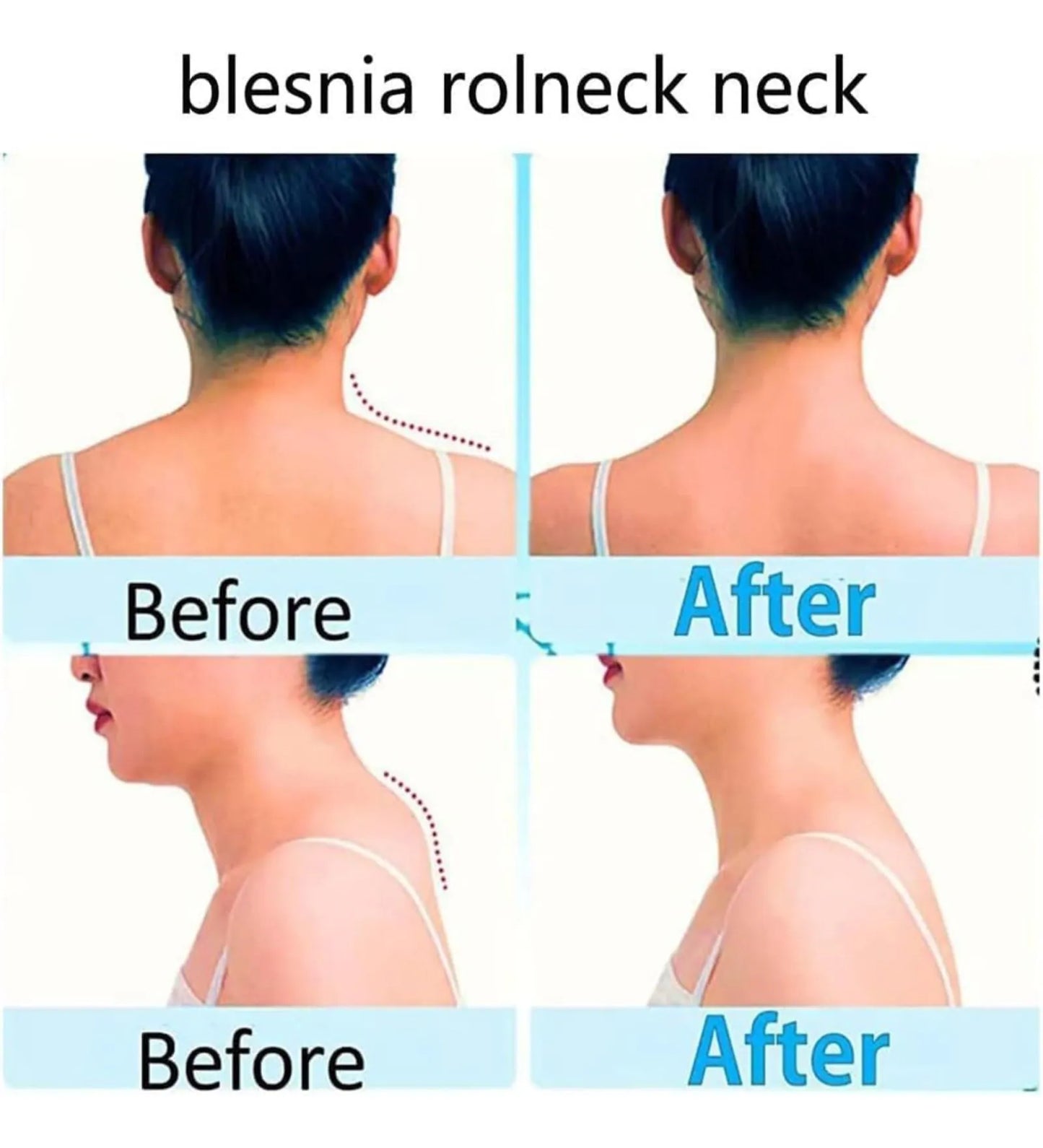 RelaxRoll™ Deep Tissue Neck & Shoulder Massager